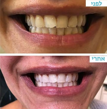 צילום מסך 2025-09-23 180124.png__PID:47ac6def-bbca-44ab-afce-94bf7a9b2f13