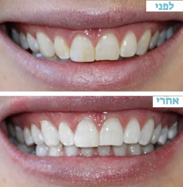 צילום מסך 2025-09-23 180534.png__PID:ce3e5a61-a6fb-4668-95ef-7e8226deeba3